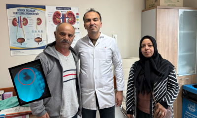 Hastanın böbreğindeki 6 santimetrelik taş kapalı ameliyatla çıkarıldı